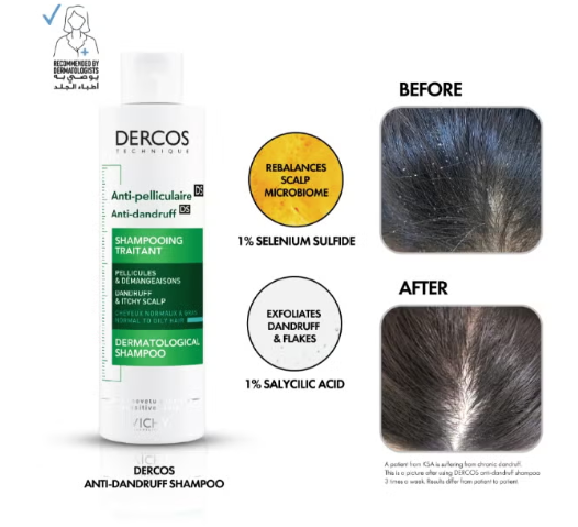 Vichy Dercos Anti-Dandruff Shampoo for Dry Hair 200 Ml
